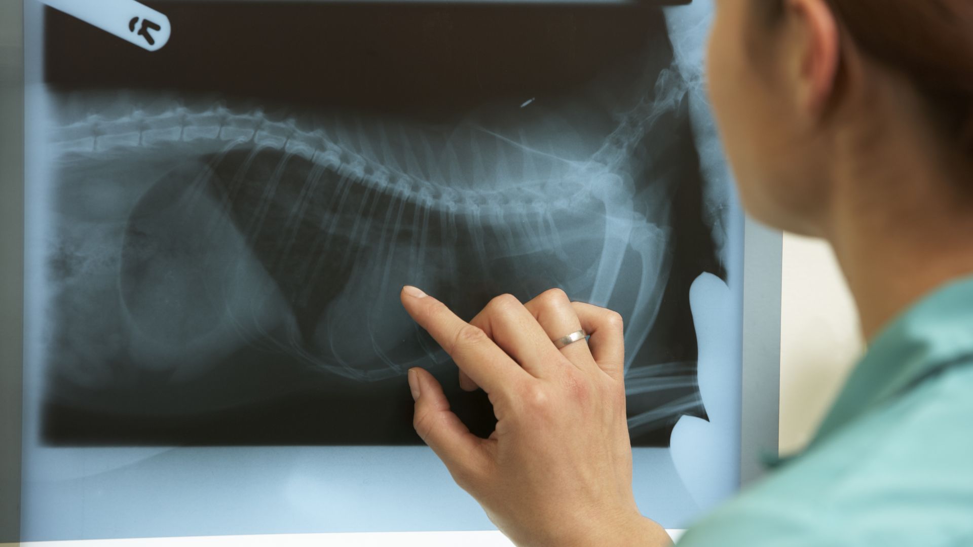 A woman examines an X-ray image